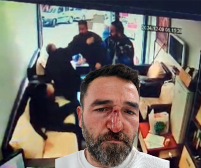 Emlakçıya tadilat dayağı; burnunu kırıp serbest kaldı
