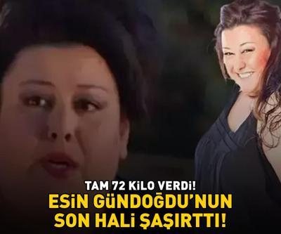 Kocan Kadar Konuşun Saniyesi Esin Gündoğdunun son hali şaşırttı Tam 72 kilo verdi
