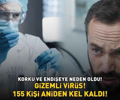 155 KİŞİ ANİDEN KEL KALDI Koronavirüs, HMPV ve Norovirüsten sonra şimdi de bu Gizemli virüs korku ve endişeye neden oldu