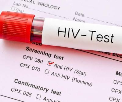 Bulaş yolları ve belirtilere dikkat HIV/AIDS, Ülkemizde 1985’ten beri bildirimi zorunlu hastalık listesinde