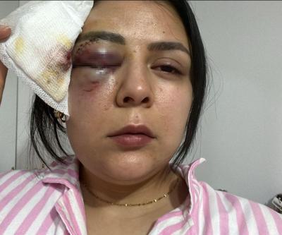 Kahramanmaraşta dehşet veren görüntüler: Durduk yere yumruk attı, yoluna devam etti