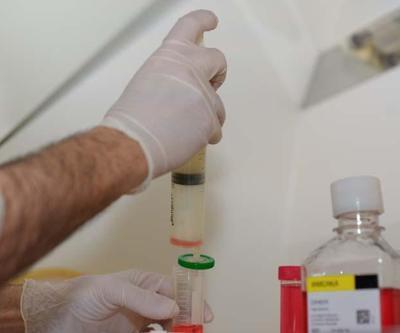Alzheimer ve Parkinson tedavisinde umut veren gelişme