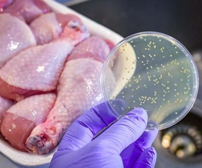 Gıda zehirlenmesinin gizli tehdidi: Salmonella Salmonella nedir, nasıl bulaşır