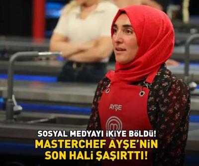 MasterChef Ayşe Ekizin son hali şoke etti Estetikli görüntüsü sosyal medyayı 2ye böldü