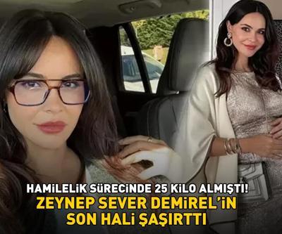 Hamilelik sürecinde 25 kilo almıştı Volkan Demirelin güzeller güzeli eşi Zeynep Sever Demirel son halini paylaştı