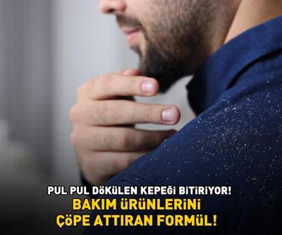 PUL PUL DÖKÜLEN KEPEĞİ BİTİRİYOR Bakım ürünlerini çöpe attıran formül 30 dakika bekletmek yetiyor