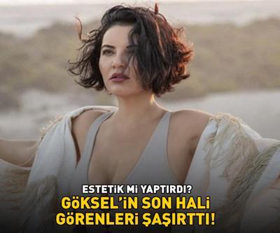 ESTETİK Mİ YAPTIRDI Gökselin son hali sosyal medyayı salladı