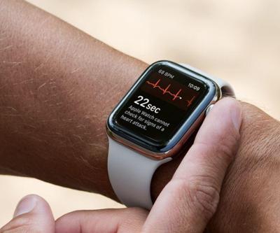 Watch Series 11 ve Apple Watch Ultra 3’te MediaTek’in modem çipi yer alacak