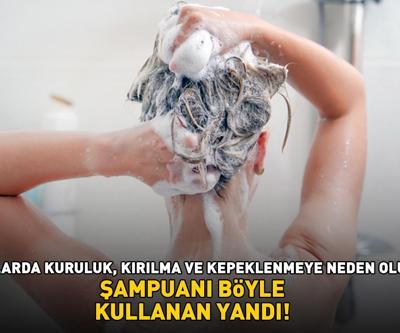 Şampuanı böyle kullanan yandı Uzman isim uyardı: Saçlarda kuruluğa ve kepeklenmeye yol açıyor