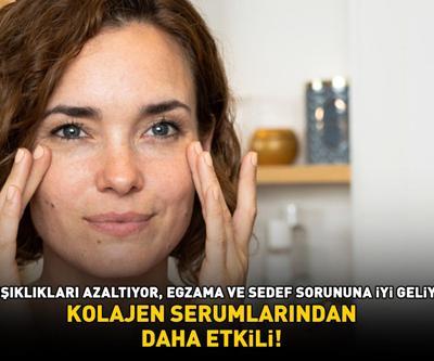Kolajen serumlarından daha etkili 10 yaş birden gençleştiriyor: Kırışıklıkları ütü gibi açıyor, egzama ve sedefe iyi geliyor