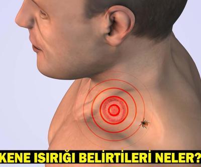 KENE ISIRIĞI BELİRTİLERİ: Kene ısırığı nasıl belli olur Kene ısırığında ilk yapılması gereken nedir Keneden korunmak için ne yapmalıyız