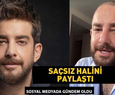 Enis Arıkanın saçsız hali gündem oldu Meğer protez saç kullanıyormuş