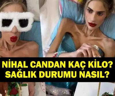 Nihal Candan Sağlık Durumu: Nihal Candan Kaç Kilo Yoğun Bakıma Alındı Nihal Candanın Anoreksiya Nervoza ile Mücadelesi