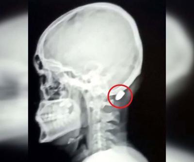 Çoğu Zaman Fark Edilmiyor, Tesadüfen Bulunuyor Uzman İsimden Hayati Uyarı: Silah Sesi Duyduğunuzda Balkona Pencereye Koşmayın