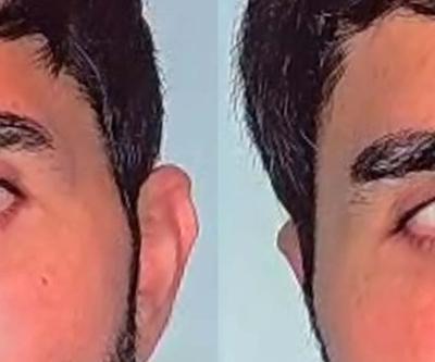 Yeşil mi, Mavi mi Göz Rengini Kalıcı Olarak Değiştirmek Mümkün İşte En Çok Talep Edilen Renk... Göz Rengi Nasıl Değiştiriliyor Göz Rengi Değiştirmenin Riski Var mı