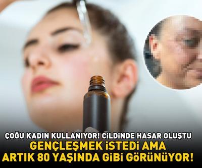 CİLDİNDE HASAR OLUŞTU Çoğu kadın kullanıyor Gençleşmek istedi ama artık 80 yaşında gibi görüyor