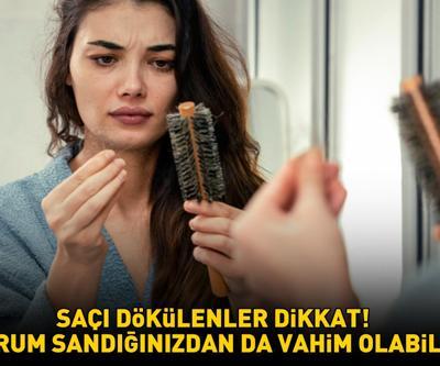 SAÇI DÖKÜLENLER DİKKAT Durum sandığınızdan da vahim olabilir: Tiroid problemleri, PKOS, Demir ve D vitamini eksikliği...