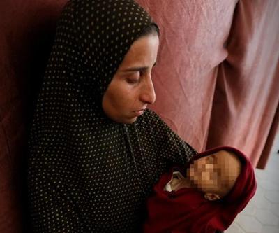 Henüz 7 aylıktı... Gazzede bir bebek daha açlıktan öldü