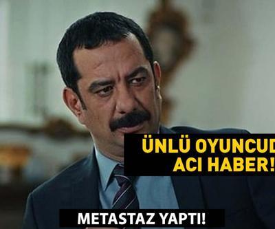 Ünlü oyuncu hayatını kaybetti Kanser karaciğerine sıçramıştı EMRE TÖRÜN KAÇ YAŞINDA