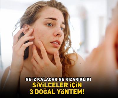 SİVİLCELER İÇİN ETKİLİ 3 DOĞAL YÖNTEM 10-15 dakika bekletmek yetiyor Ne iz kalacak ne de kızarıklık