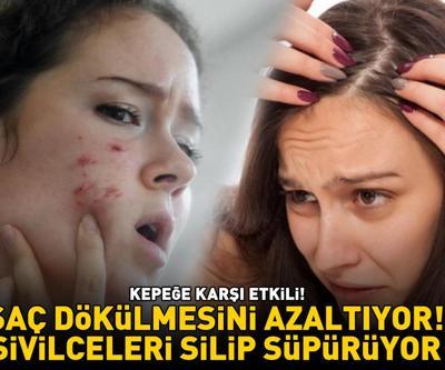 KEPEĞE KARŞI ETKİLİ Saç dökülmesini azaltıyor; ciltteki bakteriyel sorunları, akne ve sivilceleri silip süpürüyor