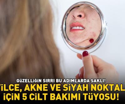 GÜZELLİĞİN SIRRI BU ADIMLARDA SAKLI Sivilce, akne ve siyah noktalar için 5 cilt bakımı tüyosu