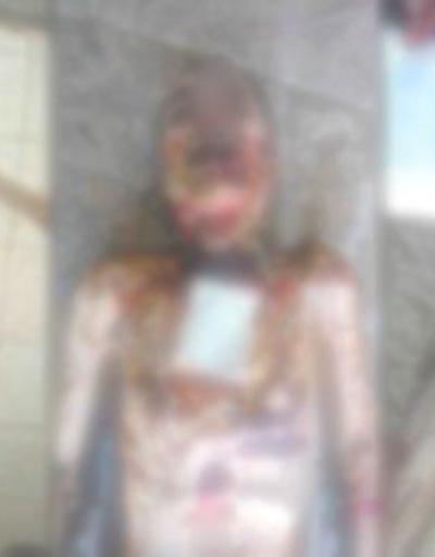 Suriyede işkence fotoğrafları