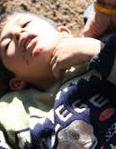Türkiye biber gazı kapsülüyle çocuk ölümünden mahkum