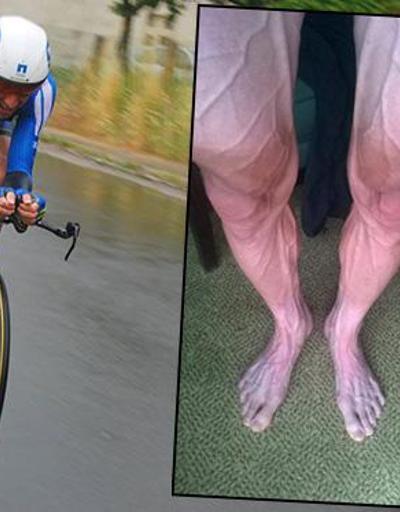 Bisikletçi Bartosz Huzarskinin bacakları şaşkınlık yarattı