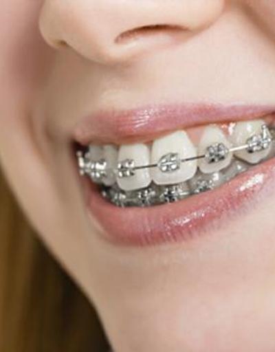 Erişkinler ortodontik tedavi görebilir mi