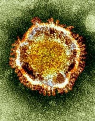 Türkiyede corona virüsünden ölüm