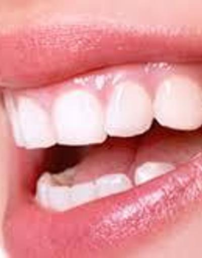Sağlıklı diş ve diş etleri için neler yapılmalıdır