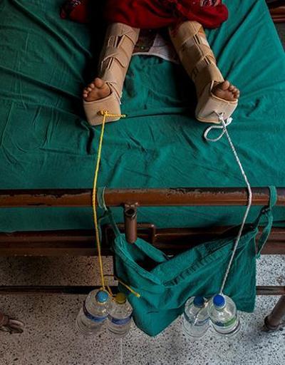 Nepalde depremden sonra yokluk: Hastanede yaralar viskiyle temizleniyor