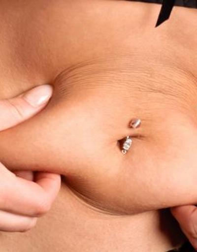 Karın germe ile kombine liposuction uygulamaları