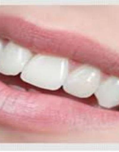 Estetik diş tedavisinde öncelikler nelerdir
