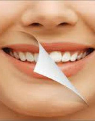 Estetik diş tedavisinde diş etinin önemi