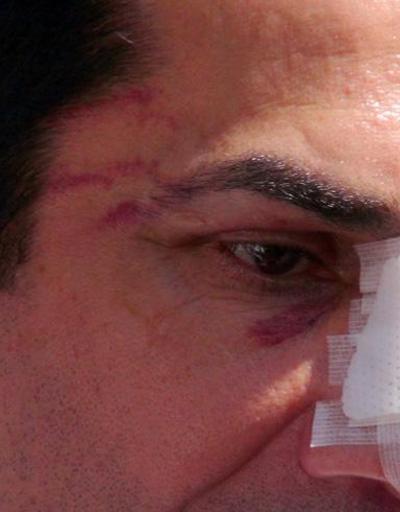 CHPli Hüseyin Sağa saldırıda iki gözaltı