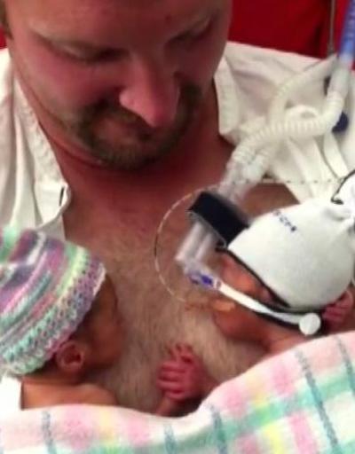 El ele tutuşan prematüre ikizler izlenme rekoru kırdı