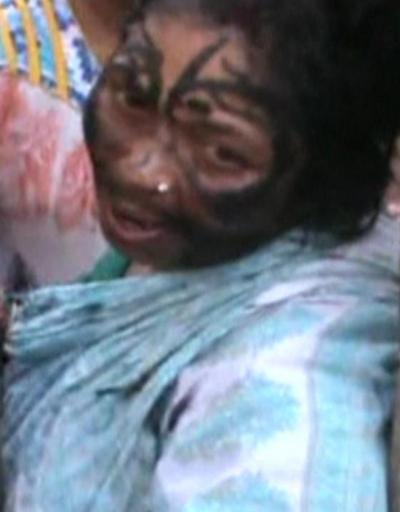 Hindistanda büyücü olduğu gerekçesiyle bir kadını dövdüler