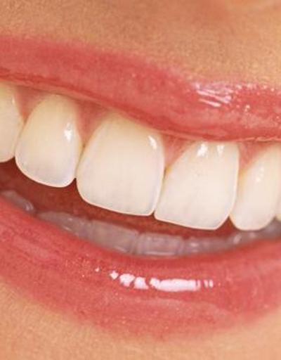 Dişlerimiz neden sararır