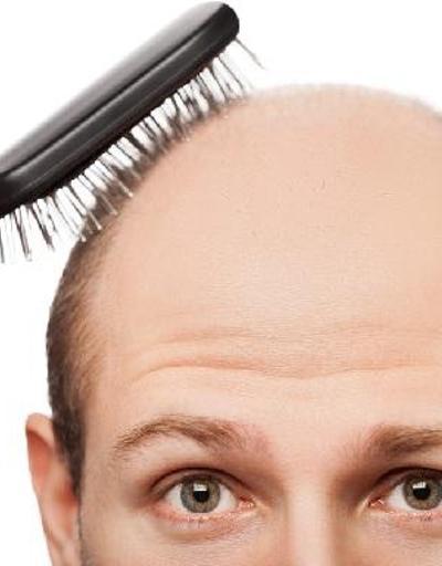 Saç dökülmesinin 20 nedeni