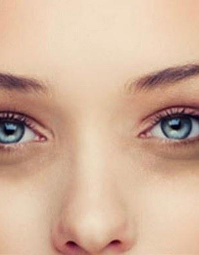 Göz altı morlukları neden olur ve nasıl geçer