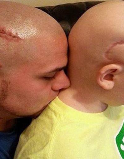 Beyin ameliyatı olan oğluna destek  için dövme yaptırdı