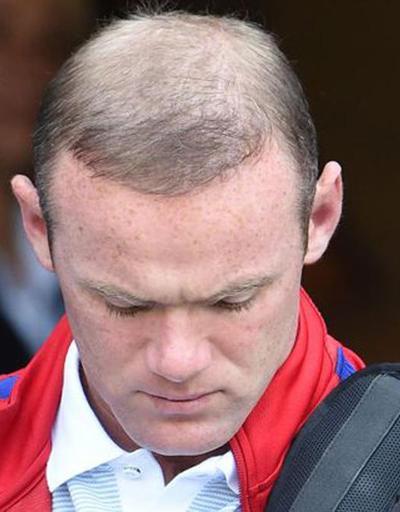 Rooney bir gecede kel kaldı