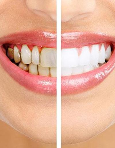 Diş sağlığı ile ilgili doğru bilinen 10 yanlış