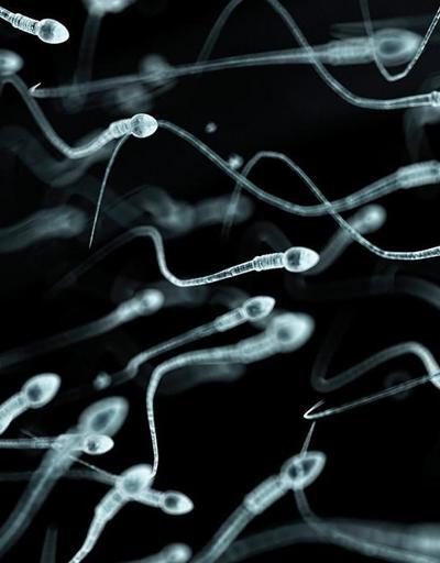 Erkeklerde kalitesiz sperm kalıtsal