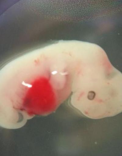 Domuz embriyosunda insan hücresi büyütüldü