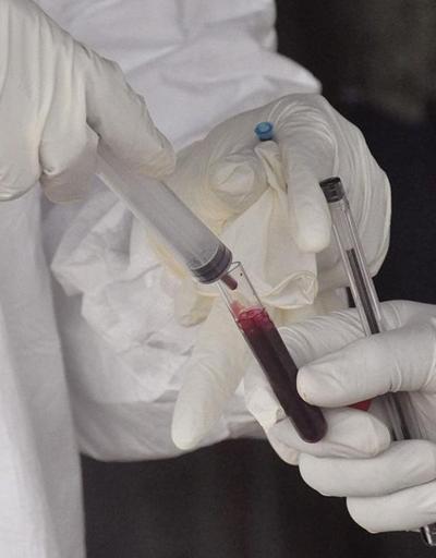 Ebola salgınına süper dağıtıcılar yol açtı