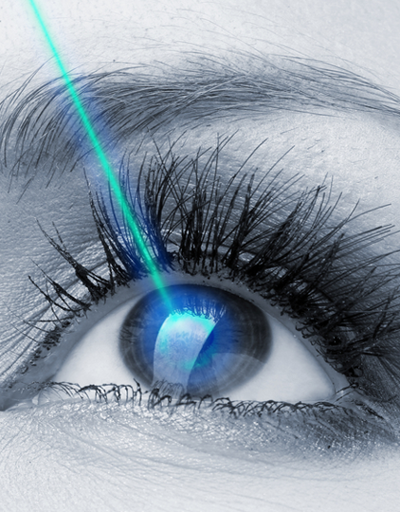 Lazerle miyop, hipermetrop ve astigmat tedavisi kimlere uygulanır