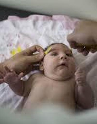 Fransa: Valproat 4 bin 100 kusurlu doğuma yol açmış olabilir